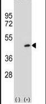 PRMT6 Antibody in Western Blot (WB)
