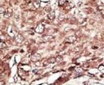 PRMT7 Antibody in Immunohistochemistry (IHC)
