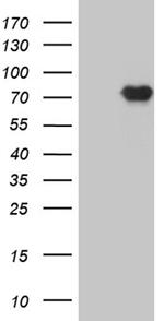 PRMT7 Antibody in Western Blot (WB)