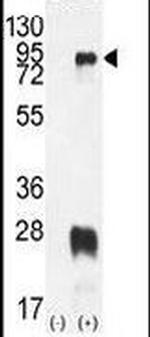PRMT7 Antibody in Western Blot (WB)