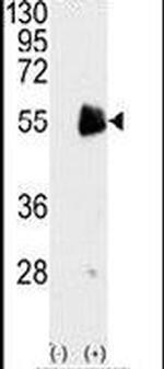 PRMT7 Antibody in Western Blot (WB)