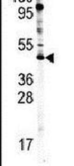 PRMT8 Antibody in Western Blot (WB)