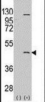 PRMT8 Antibody in Western Blot (WB)