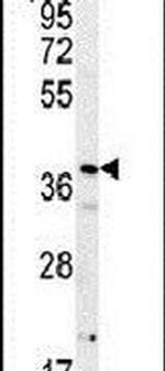 PRNPIP Antibody in Western Blot (WB)