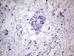 PROCR Antibody in Immunohistochemistry (Paraffin) (IHC (P))