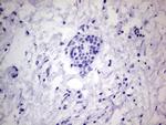 PROCR Antibody in Immunohistochemistry (Paraffin) (IHC (P))
