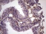 PROCR Antibody in Immunohistochemistry (Paraffin) (IHC (P))