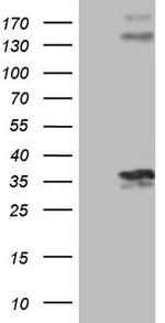PROCR Antibody in Western Blot (WB)