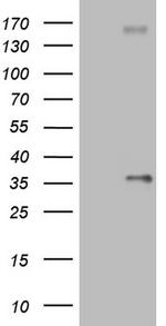 PROCR Antibody in Western Blot (WB)