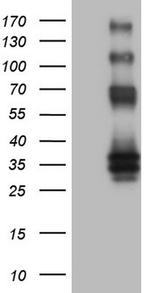 PROCR Antibody in Western Blot (WB)
