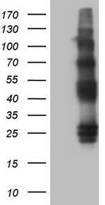PROCR Antibody in Western Blot (WB)
