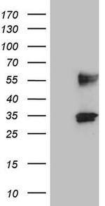 PROCR Antibody in Western Blot (WB)