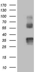 PROCR Antibody in Western Blot (WB)