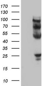 PROCR Antibody in Western Blot (WB)