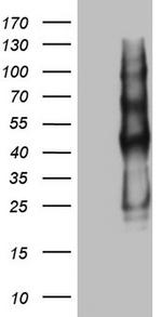 PROCR Antibody in Western Blot (WB)