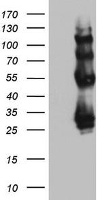 PROCR Antibody in Western Blot (WB)