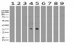 PROCR Antibody in Western Blot (WB)