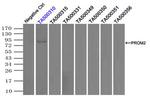 PROM2 Antibody in Immunoprecipitation (IP)