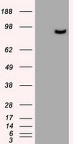 PROM2 Antibody in Western Blot (WB)