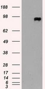 PROM2 Antibody in Western Blot (WB)