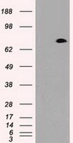 PROM2 Antibody in Western Blot (WB)