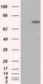 PROM2 Antibody in Western Blot (WB)