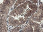 PROSC Antibody in Immunohistochemistry (Paraffin) (IHC (P))