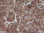 PROSC Antibody in Immunohistochemistry (Paraffin) (IHC (P))