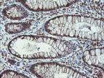 PROSC Antibody in Immunohistochemistry (Paraffin) (IHC (P))