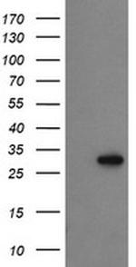 PROSC Antibody in Western Blot (WB)