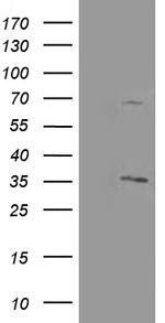 PROSC Antibody in Western Blot (WB)