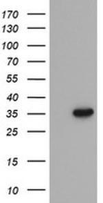 PROSC Antibody in Western Blot (WB)