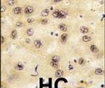 PROX1 Antibody in Immunohistochemistry (IHC)