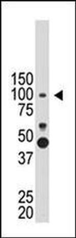 PROX1 Antibody in Western Blot (WB)