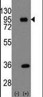 PROX1 Antibody in Western Blot (WB)