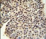 PRP19 Antibody in Immunohistochemistry (IHC)