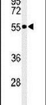PRP19 Antibody in Western Blot (WB)