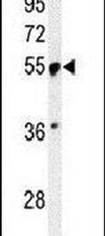 PRP19 Antibody in Western Blot (WB)
