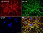 PRPH Antibody in Immunocytochemistry (ICC/IF)