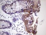 PRPH Antibody in Immunohistochemistry (Paraffin) (IHC (P))
