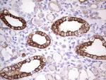 PRPH Antibody in Immunohistochemistry (Paraffin) (IHC (P))