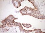 PRPH Antibody in Immunohistochemistry (Paraffin) (IHC (P))
