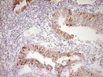 PRPH Antibody in Immunohistochemistry (Paraffin) (IHC (P))