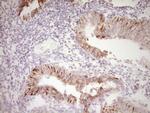 PRPH Antibody in Immunohistochemistry (Paraffin) (IHC (P))
