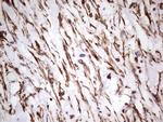 PRPH Antibody in Immunohistochemistry (Paraffin) (IHC (P))