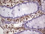 PRPH Antibody in Immunohistochemistry (Paraffin) (IHC (P))