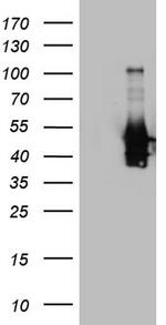 PRPH Antibody in Western Blot (WB)