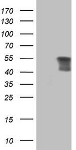 PRPH Antibody in Western Blot (WB)