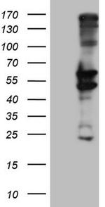 PRPH Antibody in Western Blot (WB)