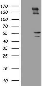 PRPH Antibody in Western Blot (WB)